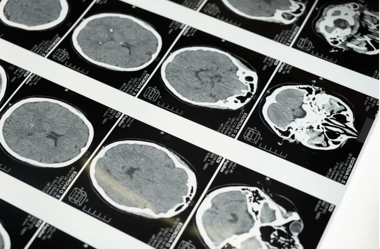 Teleradiologia – jak działa i dlaczego coraz częściej zastępuje tradycyjne opisy badań?